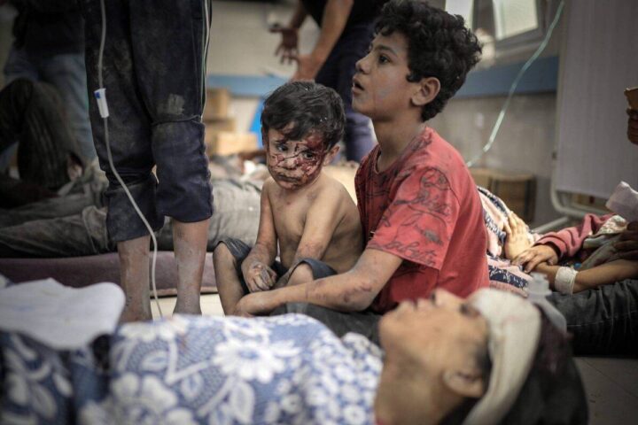 Genocidio israelo-statunitense a Gaza: 284° giorno. 320 tra uccisi e feriti nelle ultime 48 ore. Israele sta usando armi proibite che bruciano i corpi
